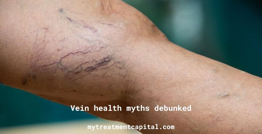 Vein Health Myths Debunked: Separating Fact from Fiction