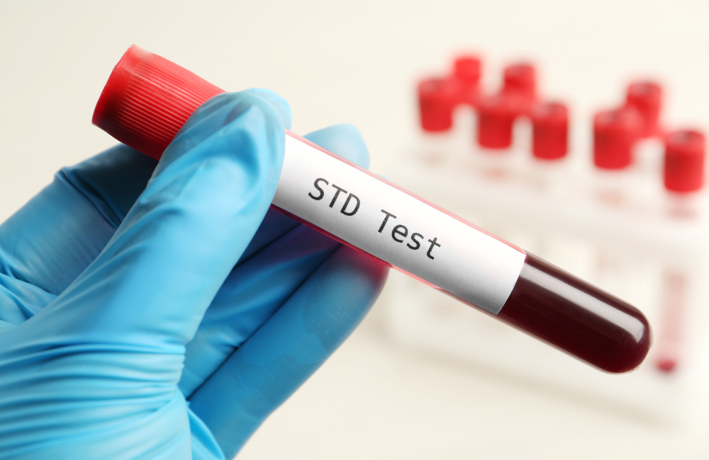 STD Testing Singapore: Answers for Frequently Asked Questions