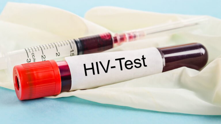 HIV testing